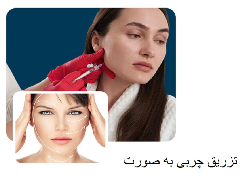 تزریق چربی به صورت