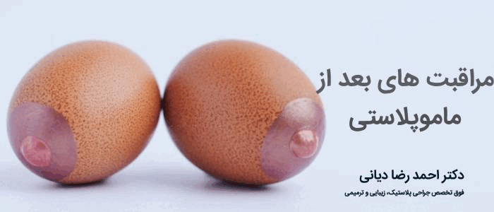 مراقبت های بعد از ماموپلاستی