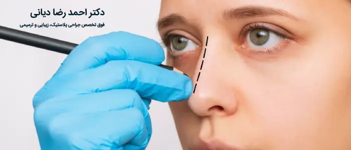 بهترین جراح بینی در زعفرانیه