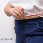 مراقبت های بعد از ابدومینوپلاستی