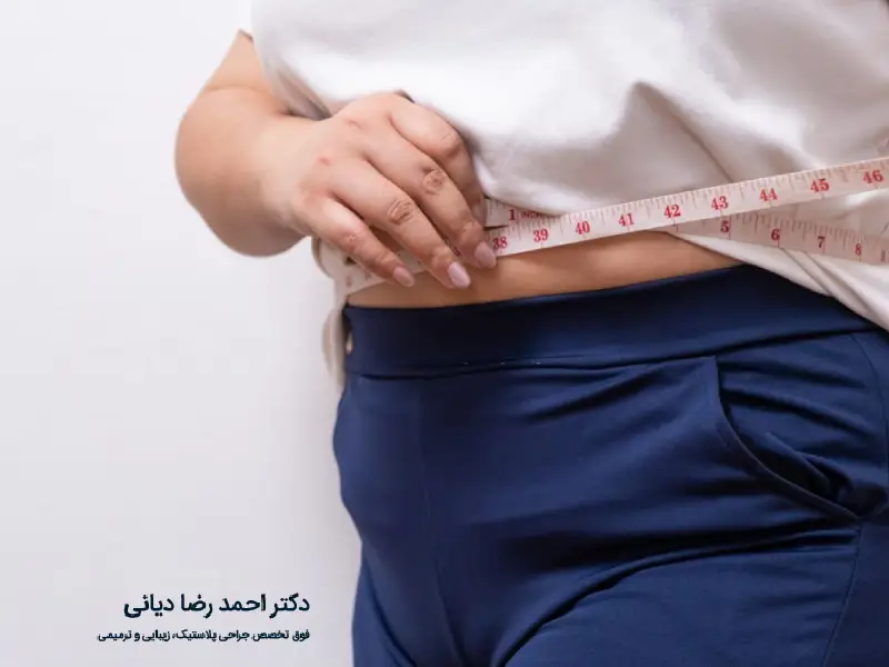 مراقبت های بعد از ابدومینوپلاستی