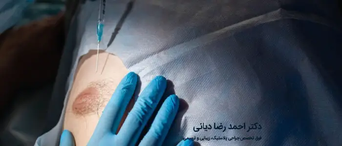 ژنیکوماستی چیست