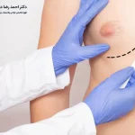 ژنیکوماستی چیست