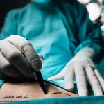 بهترین جراح پیکرتراشی در تهران