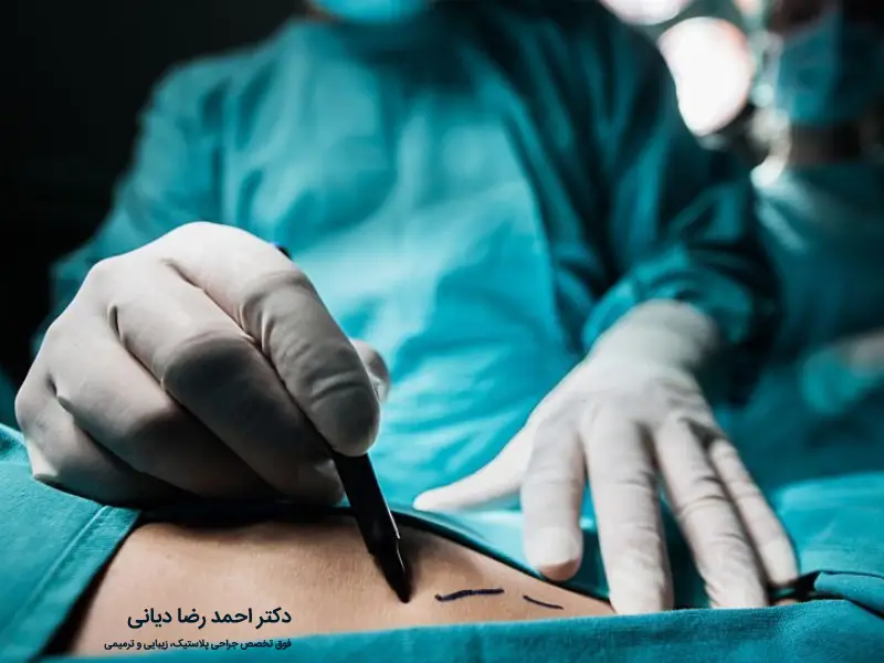 بهترین جراح پیکرتراشی در تهران