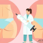 تزریق چربی به باسن