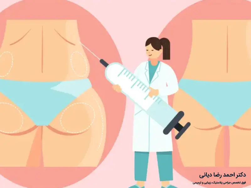 تزریق چربی به باسن