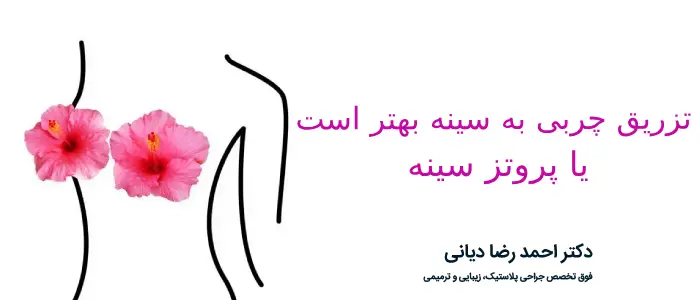 تزریق چربی به سینه بهتر است یا پروتز سینه