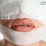 مراقبت های بعد از لیفت صورت