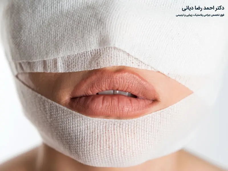 مراقبت های بعد از لیفت صورت