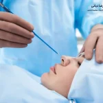 هزینه جراحی بینی در سال 1402