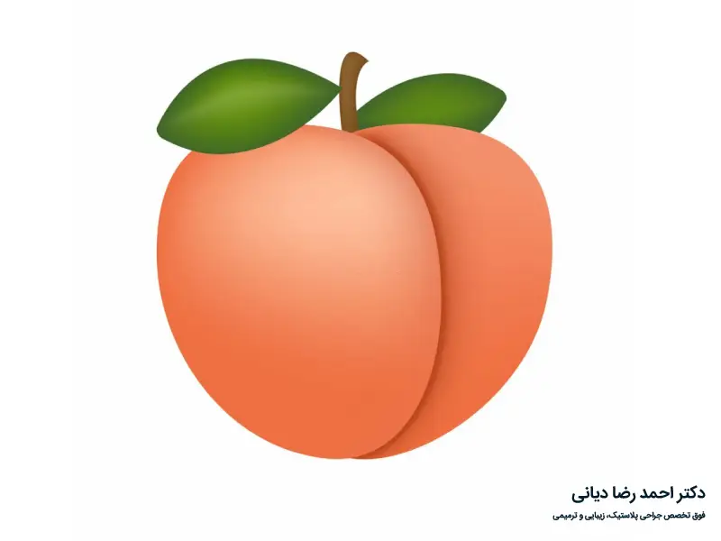 مراقبت های بعد از تزریق چربی به باسن
