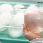 مراقبت های بعد از پروتز سینه