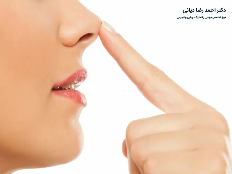 جراحی بینی نیمه فانتزی
