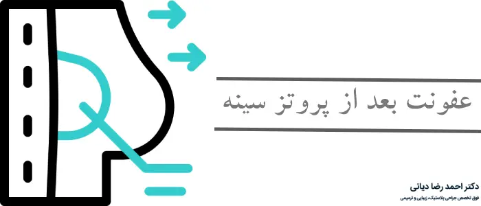 عفونت بعد از پروتز سینه