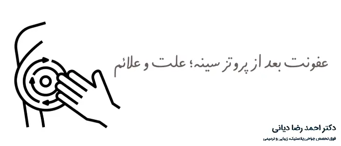 عفونت بعد از پروتز سینه