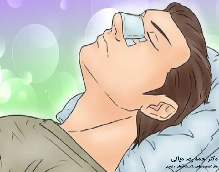 خوابیدن بعد از جراحی بینی