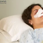 نحوه خوابیدن بعد از جراحی بینی