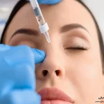 تزریق کورتون بعد از جراحی بینی