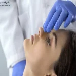 چسب زدن بینی