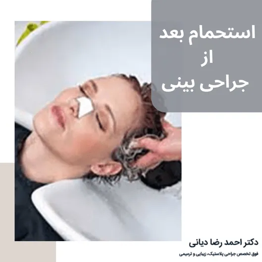 استحمام بعد از عمل بینی