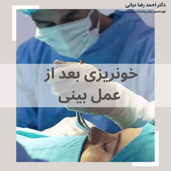 خونریزی بعد از عمل بینی
