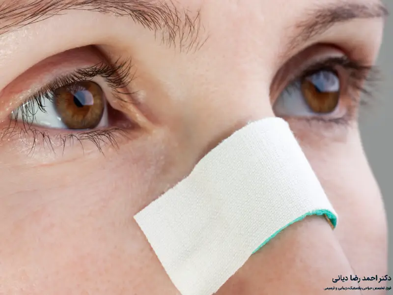آلرژی و عمل بینی