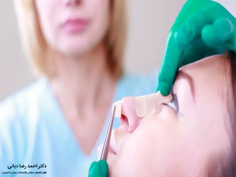 استحمام بعد از عمل بینی