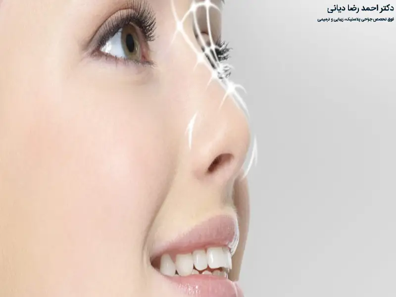 خونریزی بعد از عمل بینی