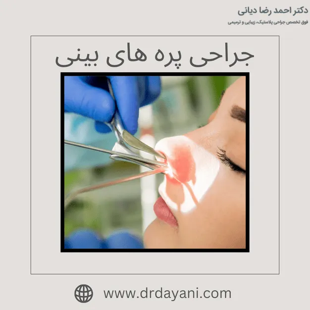 جراحی پره های بینی
