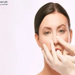 سرما خوردگی بعد از عمل بینی