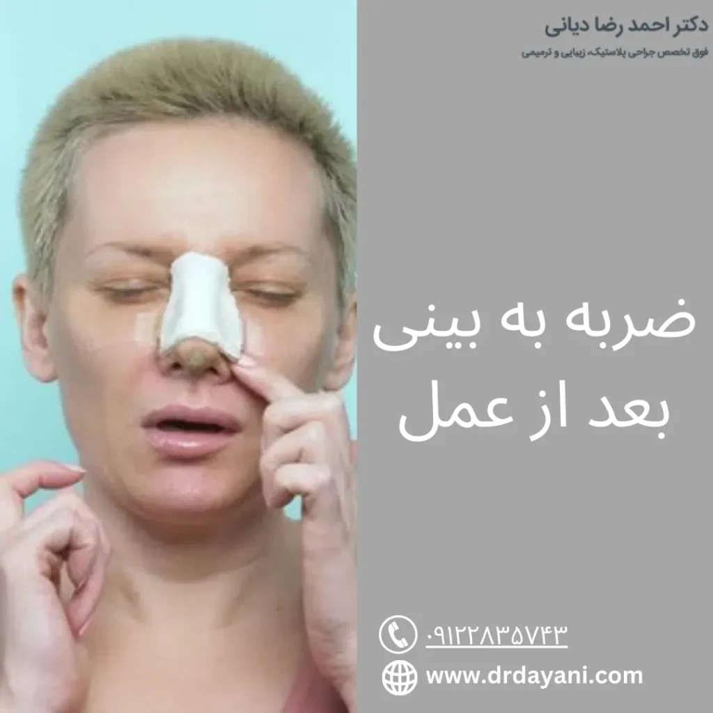 ضربه به بینی بعد از عمل