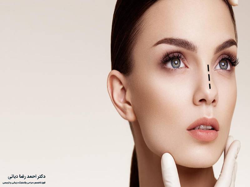 جراحی بینی طبیعی
