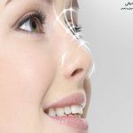 تاثیر جراحی بینی بر زیبایی چشم 