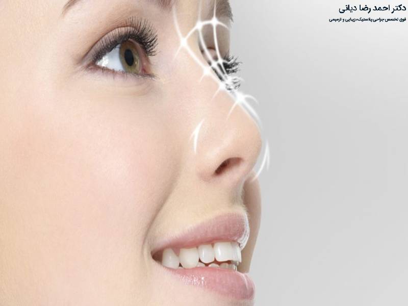 تاثیر جراحی بینی بر زیبایی چشم 