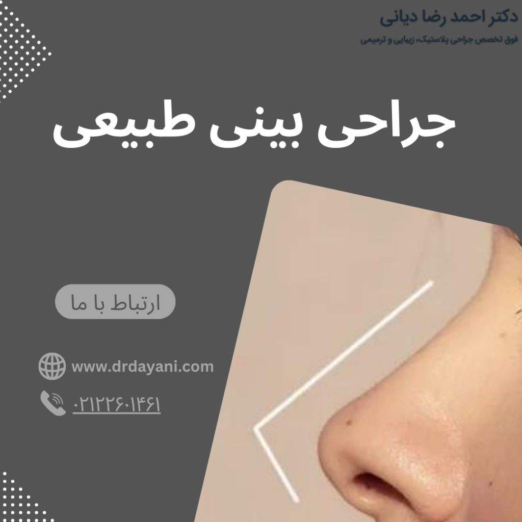 جراحی بینی طبیعی