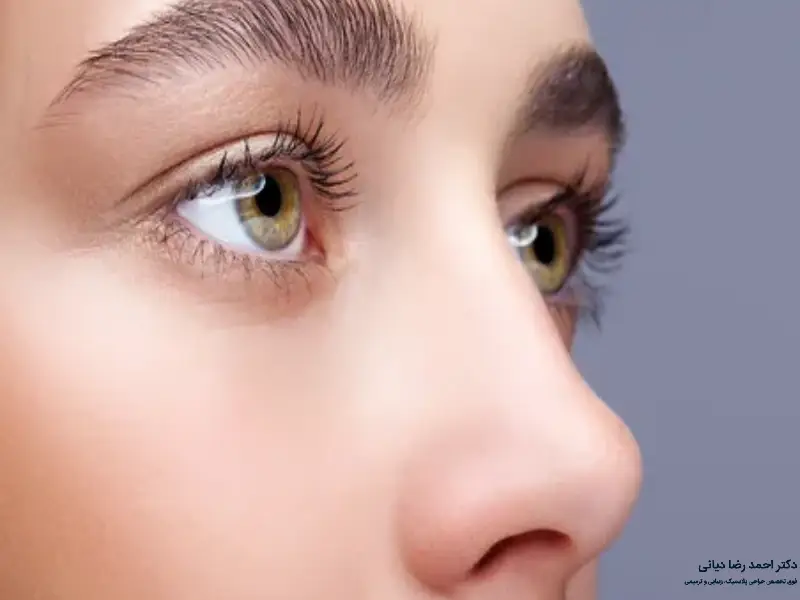 ضربه به بینی بعد از عمل